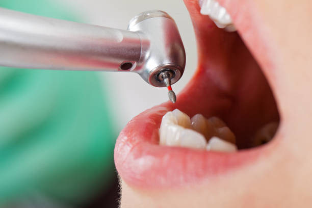 Best Emergency Gum Treatment in Whitney, TX